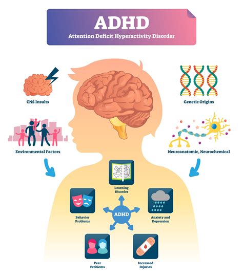 adhd vector illustration labeled attention deficit hyperactivity disorder scheme examples