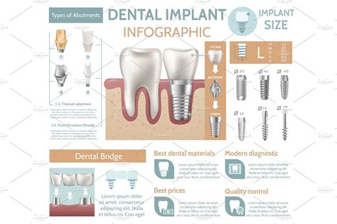 Dental Implant Tooth Care Medical Center Dentist Clinic Website