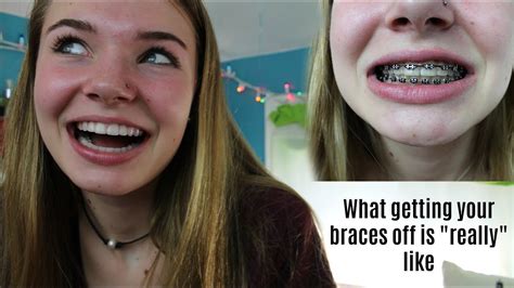 Getting My Braces Off Experience Youtube