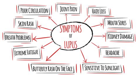 Signs And Symptoms Of Lupus Elite Hospital Kingwood