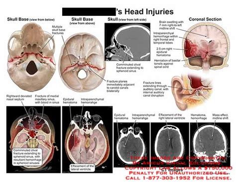 Medical Exhibits, Demonstrative Aids, Illustrations and Models