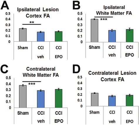 Bilateral (from latin bis 'twice'): Ipsilateral cortex and bilateral subcortical white matter ...