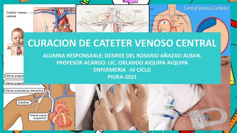 Cateter Venoso Central CVC Enfermagem Ilustrada 54 OFF