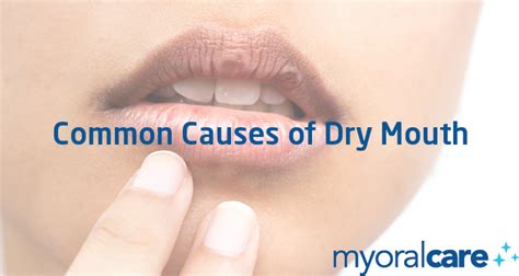 Common Causes Of Dry Mouth Education
