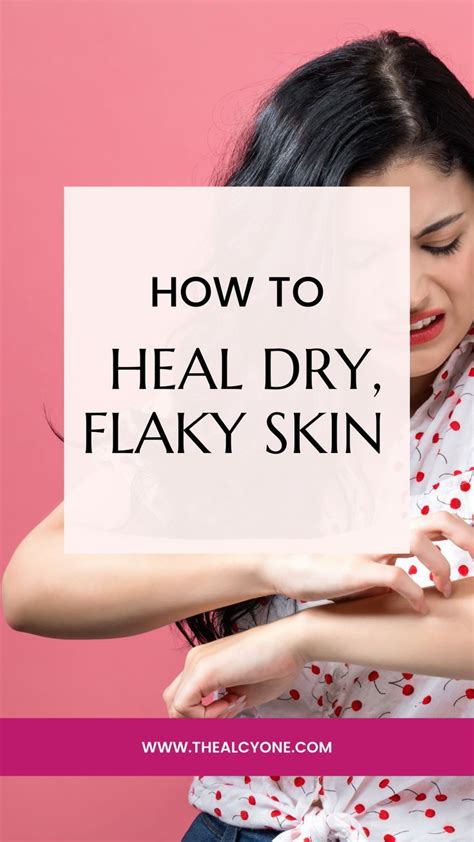 How To Heal Dry Flaky Skin Artofit