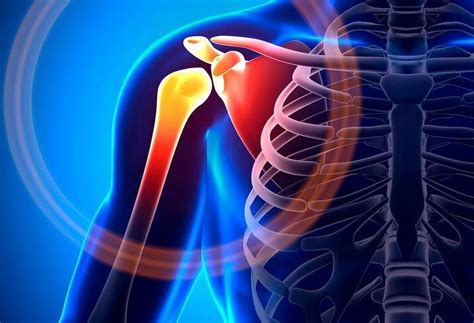 Shoulder Pain Diagnosis Chart Causes And Treatment