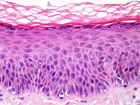 Webmd's skin anatomy page provides a detailed image of the skin and its parts as well as a medical definition. Skin ~ Medical student education - Tissupath