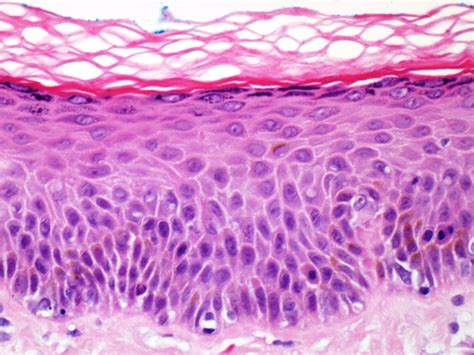 Human skin color ranges from the darkest brown to the lightest hues. Skin ~ Medical student education - Tissupath