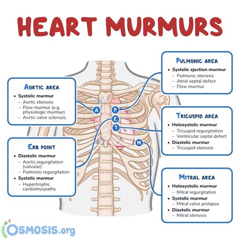 Brown Journal Of Hospital Medicine On Twitter Heart Murmurs