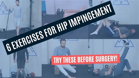 Exercise For Hip Impingement What To Do And What Not To Do