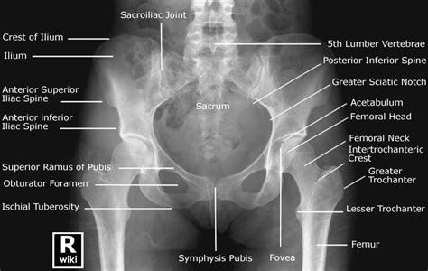 Pelvis Radiographic Anatomy Wikiradiography