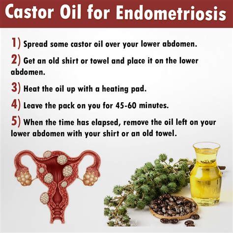 Natural Remedies For Endometriosis Endometriosis Endometriosis Diet