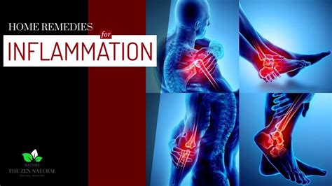Natural Remedies For Inflammation Youtube