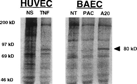 Ferran gueguen catherine christiane évolue sur le secteur d'activité : Immunoprecipitation of the A20 protein in BAECtransfected ...
