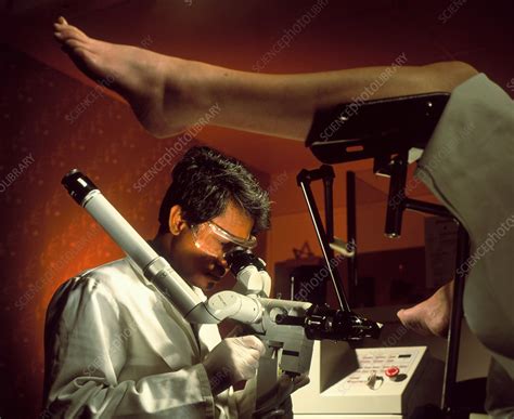 Coloscopy Laser Operation On A Womans Cervix Stock Image M8520046