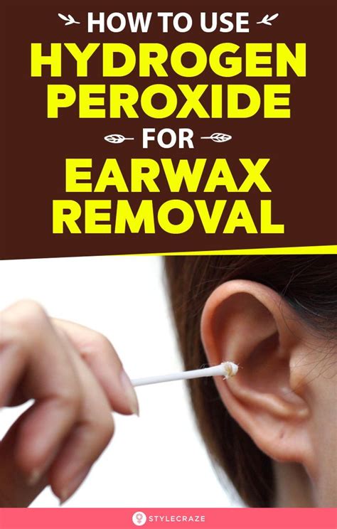 How To Use Hydrogen Peroxide For Earwax Removal In 2020 Ear Wax Ear