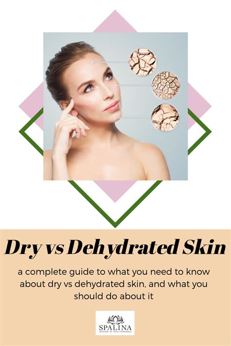 Dry Versus Dehydrated Skin Spalina Inc Dehydrated Skin Skin