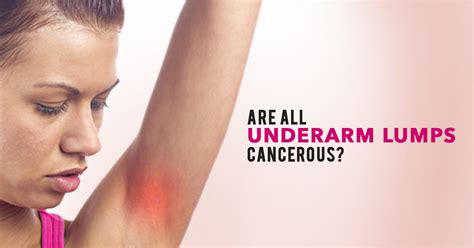 Worried About An Underarm Lumps Find Out What It Means