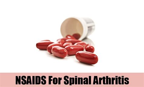 What Is Spinal Arthritis Natural Home Remedies And Supplements