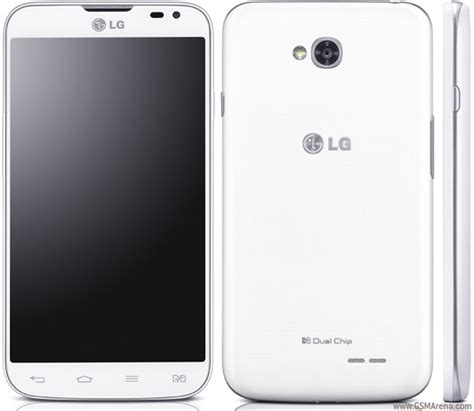 LG L70 Dual D325 pictures, official photos