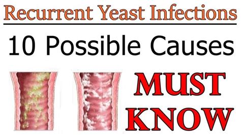 Why Do I Keep Getting Yeast Infections And Bacterial Infections