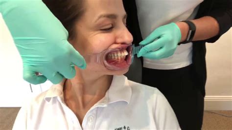 Clinical Orthodontic Photography Demo By Boss And Dr Katyal Youtube