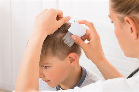 Head Lice What You Need To Know Brauer Natural Medicines