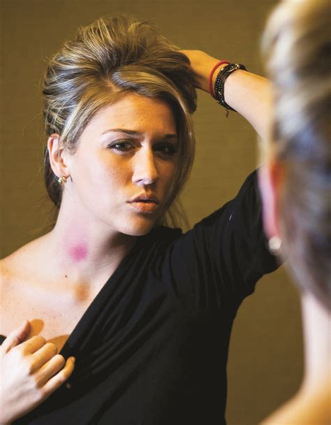 A hickey is generally perceived as a mark of deep love, pride, possession, and trust. 14 Tried And Tested Ways How To Get Rid Of A Hickey