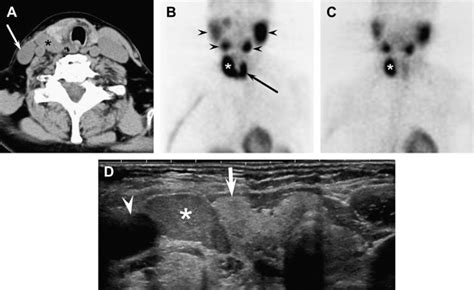 Parathyroid Imaging Radiology Key