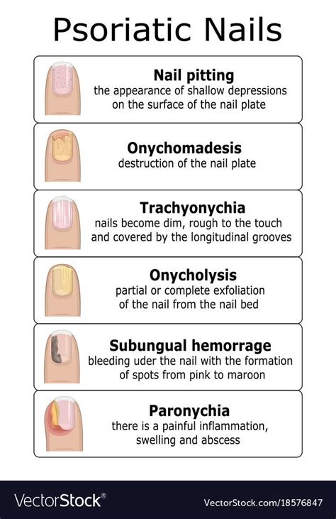 Nail Bed Damage Nail Diseases And Disorders Cosmetology State Board