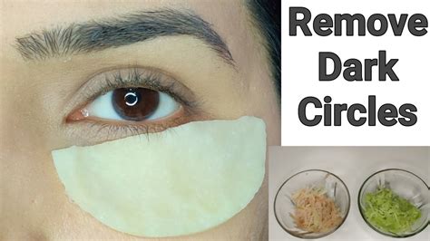 How To Remove Dark Circles Under Eyes Home Remedies To Reduce Dark