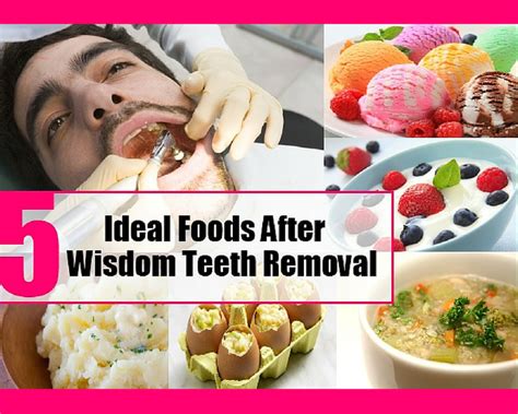 A patient should gradually reintroduce solid food after at least a. Wisdom Teeth Food Day 3