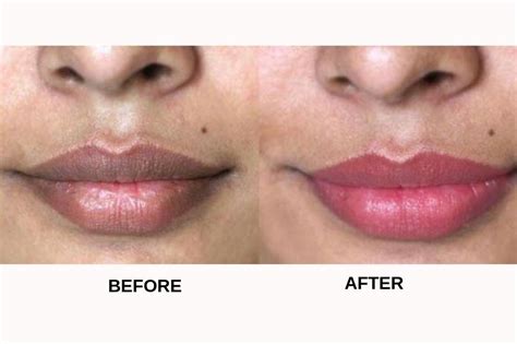 Before checking the amazing tips to lighten dark lips naturally, let us first see the reasons why we have partial dark or dark lips How To Lighten Dark Lips - 10 Most Effective Remedies | Fabbon