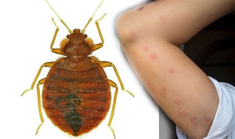78,000+ vectors, stock photos & psd files. Bed bugs: When a person sees these black spots it could ...