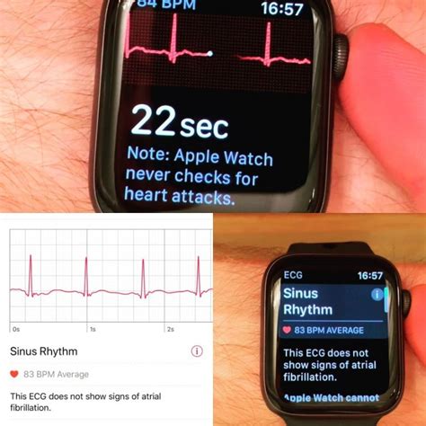 Apple Watch Electrocardiogram Ecg 5 Things You Need To Know Page