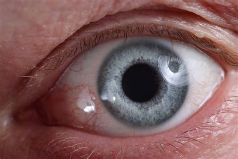 Penyebab Pupil Mata Membesar Dan Tips Menjaga Kesehatan Mata Orami