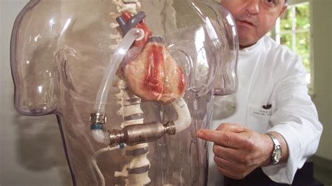 Scientists Race To Create Artificial Hearts