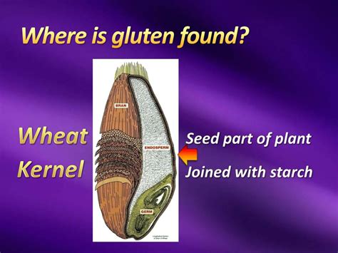 Ppt Gluten Free Diets Powerpoint Presentation Free Download Id1834800
