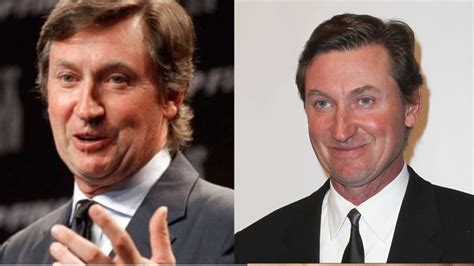 Wayne Gretzky Plastic Surgery Did He Get Cosmetic Enhancements