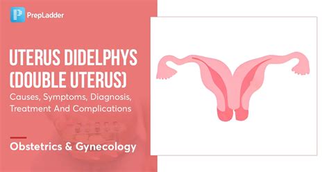 Uterus Didelphysdouble Uterus Causes Symptoms Diagnosis Treatment