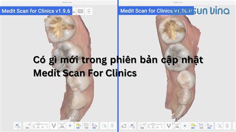 Samsun Vina C G M I Trong B N C P Nh T Medit Scan For Clinics V