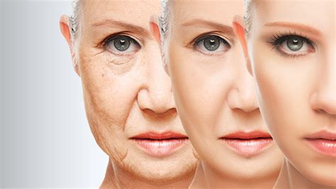 Facial Volume Loss Treatments Mmc Medical Aesthetics