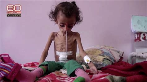 “60 minutes” features yemen on the brink of famine world food program usa