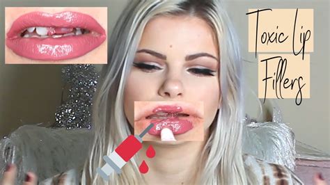 Why I Will Never Get Lip Filler Youtube