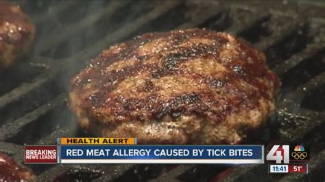 Red Meat Allergy Caused By Tick Bites Youtube