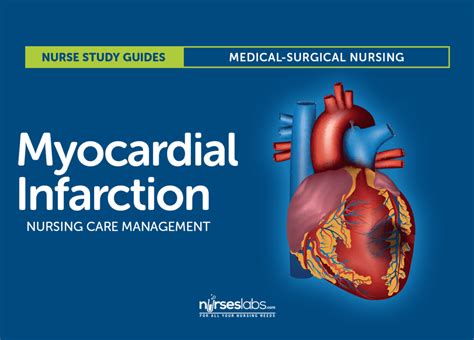 Documents similar to nursing care plan for myocardial infarction. Myocardial Infarction | Myocardial infarction, Acute ...