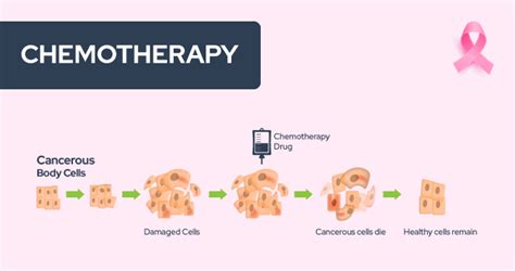 Demystifying Breast Cancer And Its Treatment