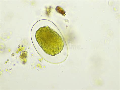 Egg Of Hookworm In Human Stool Stock Photo Image Of Fluke Laboratory