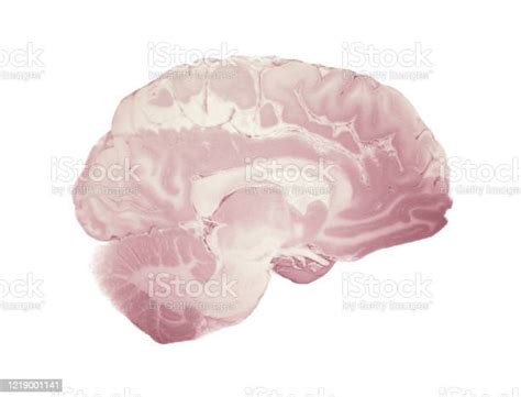 Median Section Of The Brain Anatomy Of The Human Brain Stock Photo