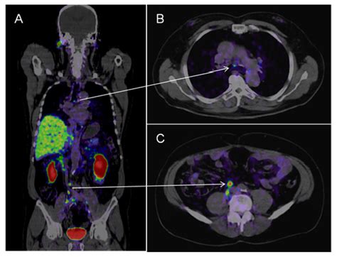 Ijms Free Full Text Molecular And Functional Imaging For Detection